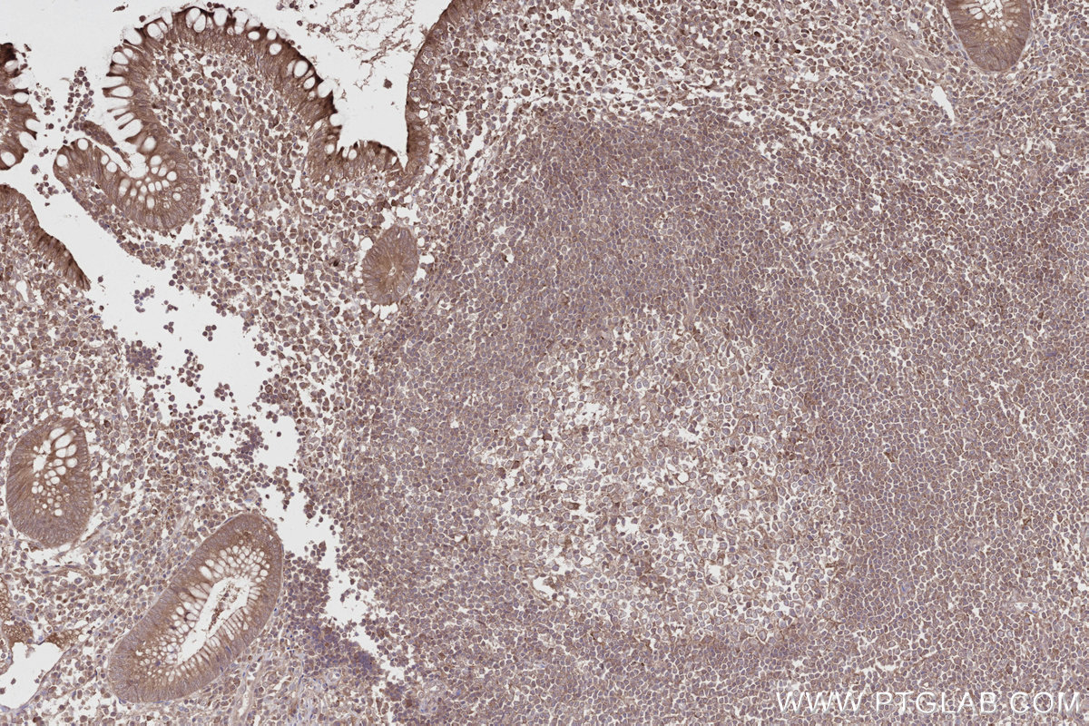 Immunohistochemical analysis of paraffin-embedded human appendicitis tissue slide using KHC2811 (PRAP1 IHC Kit).