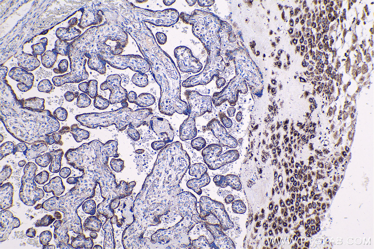 Immunohistochemical analysis of paraffin-embedded human placenta tissue slide using KHC0562 (PRDX3 IHC Kit).