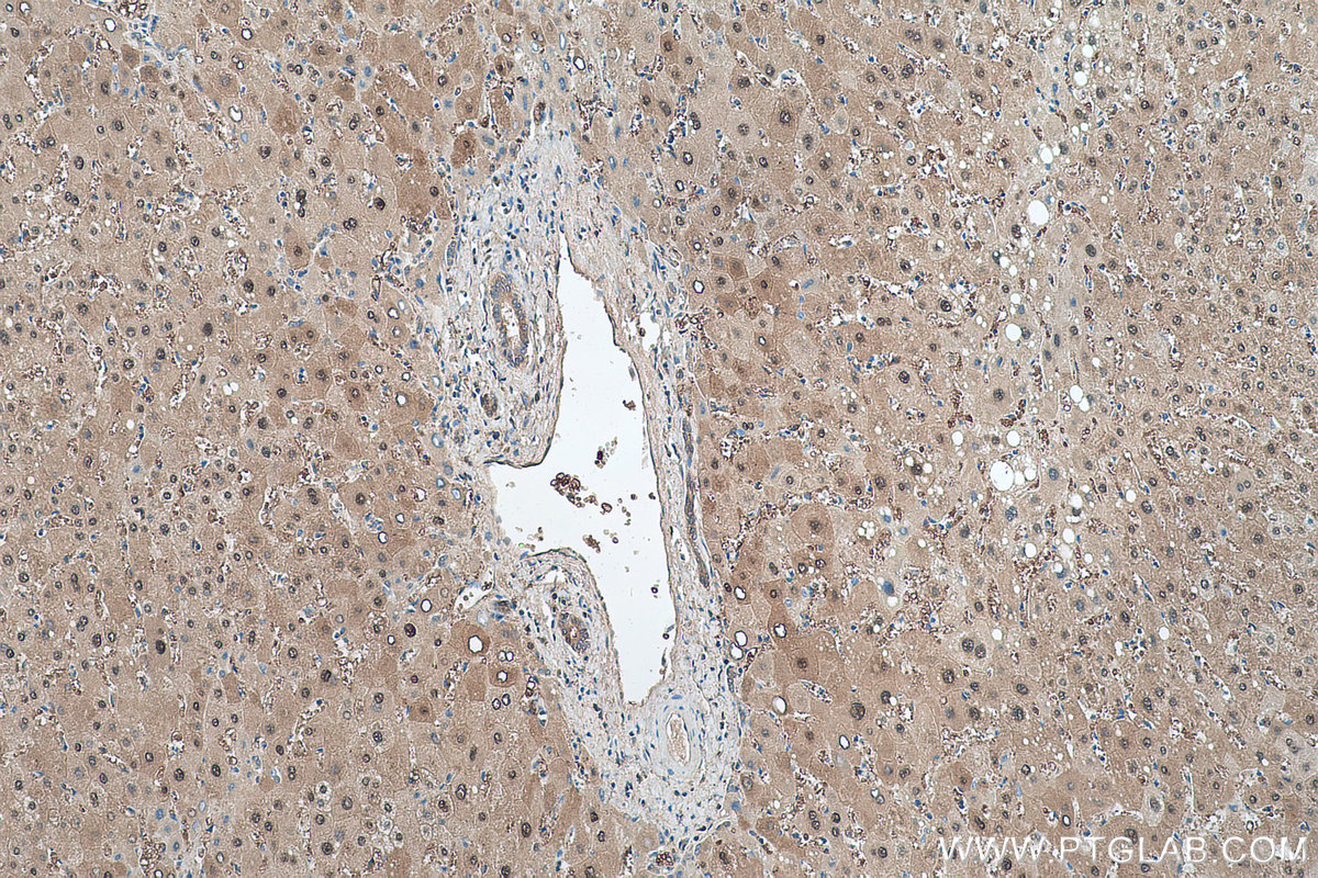 Immunohistochemical analysis of paraffin-embedded human liver tissue slide using KHC0513 (PRDX6 IHC Kit).