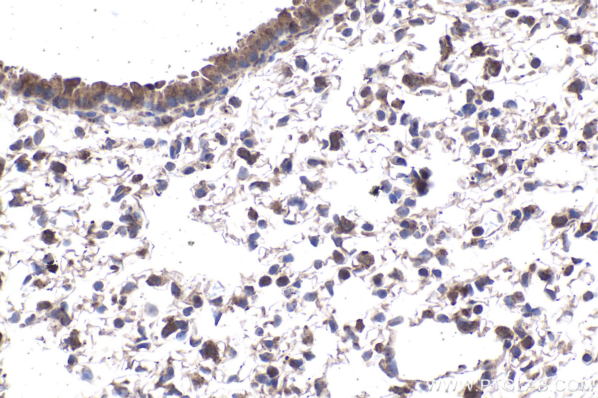 Immunohistochemical analysis of paraffin-embedded mouse lung tissue slide using KHC1948 (PREB IHC Kit).