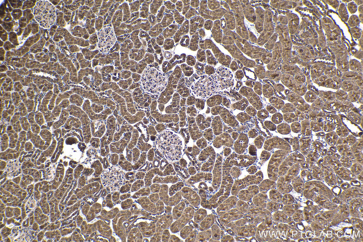 Immunohistochemical analysis of paraffin-embedded rat kidney tissue slide using KHC1628 (PRKAA2 IHC Kit).