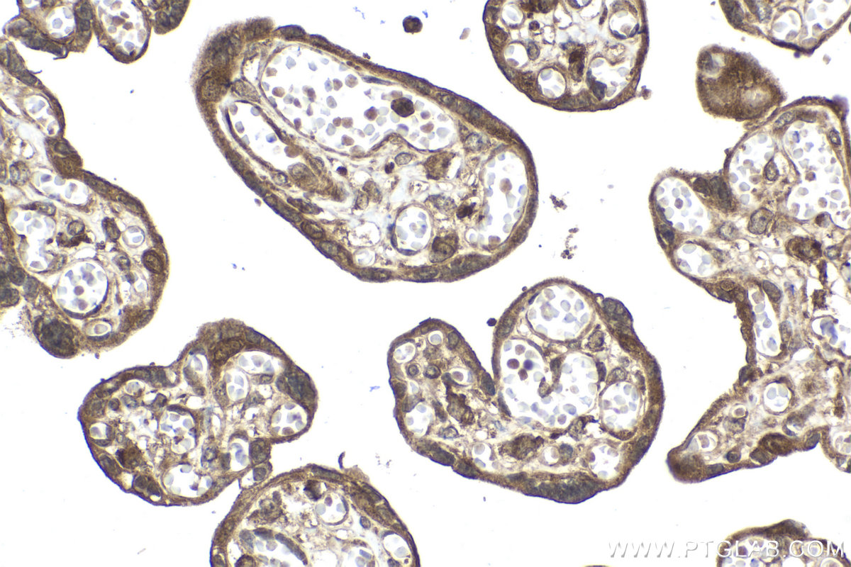 Immunohistochemical analysis of paraffin-embedded human placenta tissue slide using KHC2093 (PRKAB2 IHC Kit).