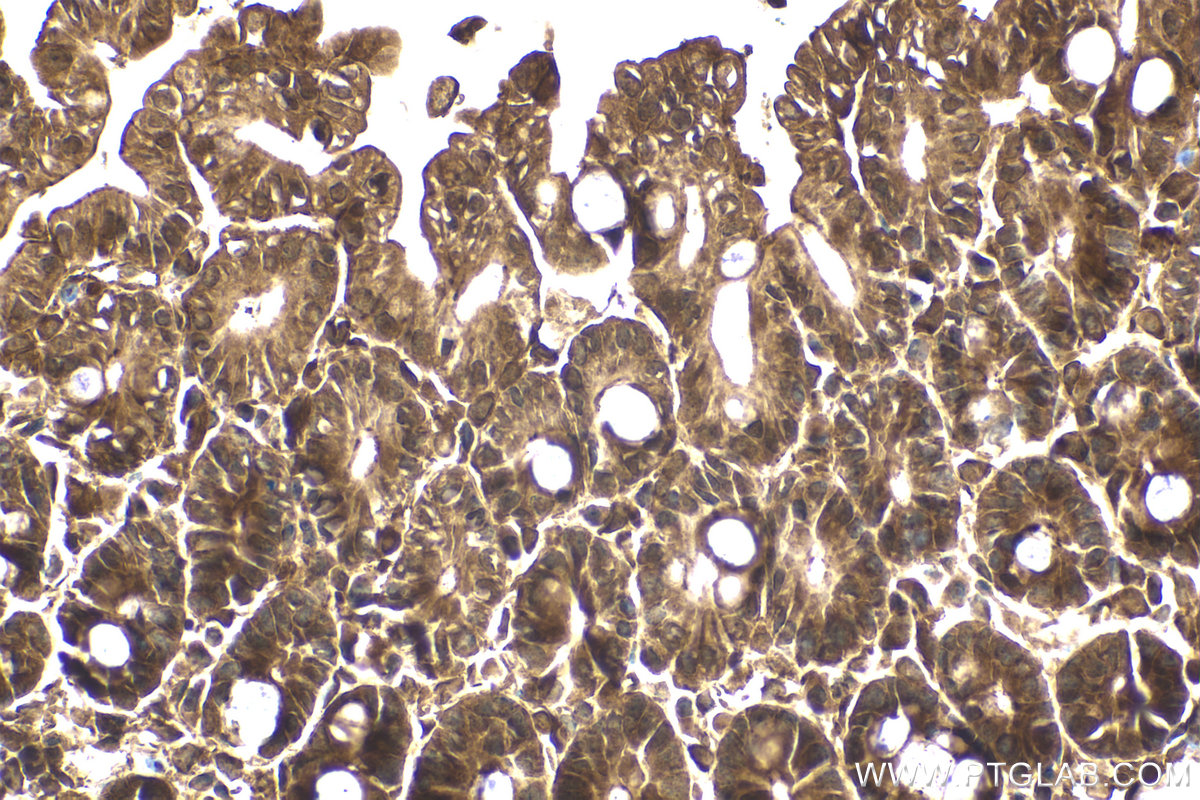 Immunohistochemical analysis of paraffin-embedded mouse intestine tissue slide using KHC2093 (PRKAB2 IHC Kit).