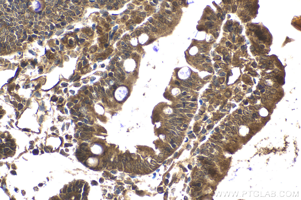 Immunohistochemical analysis of paraffin-embedded rat small intestine tissue slide using KHC2093 (PRKAB2 IHC Kit).