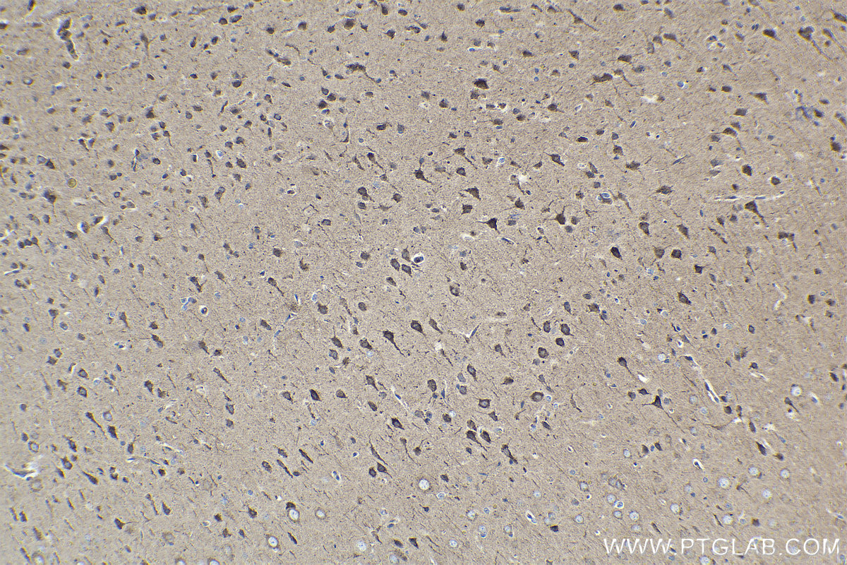 Immunohistochemical analysis of paraffin-embedded rat brain tissue slide using KHC1540 (PRKACA IHC Kit).