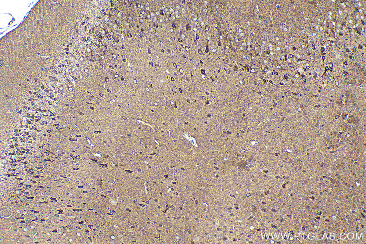 Immunohistochemical analysis of paraffin-embedded rat brain tissue slide using KHC1539 (PRKCA IHC Kit).