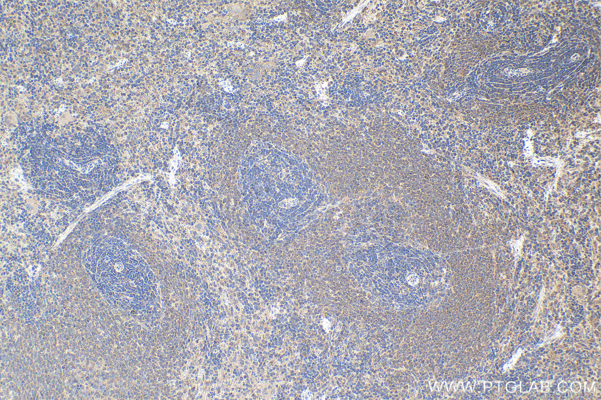 Immunohistochemical analysis of paraffin-embedded rat spleen tissue slide using KHC1510 (PRKCB IHC Kit).