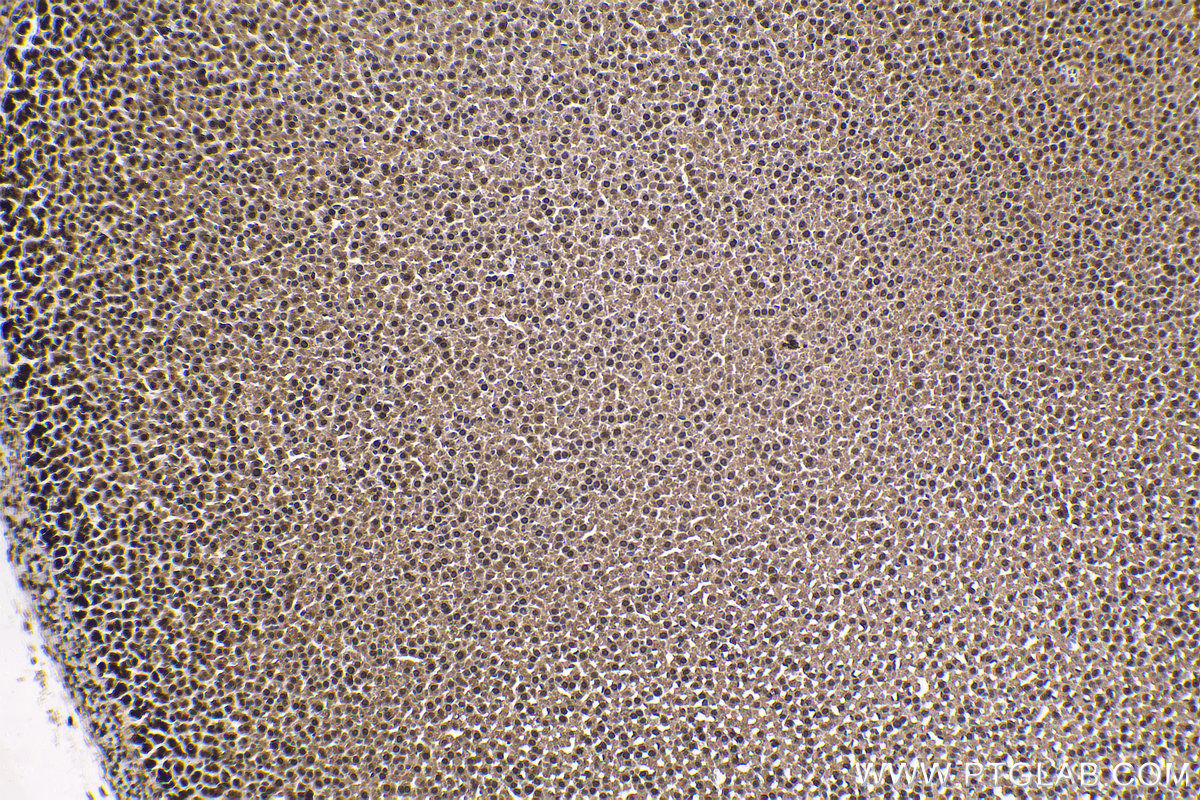 Immunohistochemical analysis of paraffin-embedded rat adrenal gland tissue slide using KHC1676 (PRKCD IHC Kit).