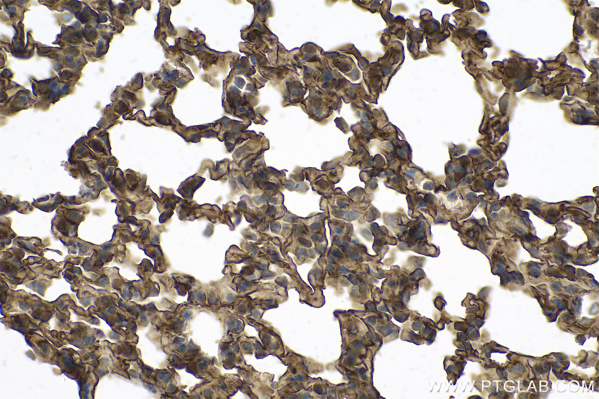 Immunohistochemical analysis of paraffin-embedded mouse lung tissue slide using KHC0786 (PRKCI IHC Kit).