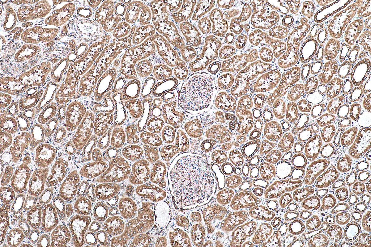 Immunohistochemical analysis of paraffin-embedded human kidney tissue slide using KHC0698 (PRKCSH IHC Kit).