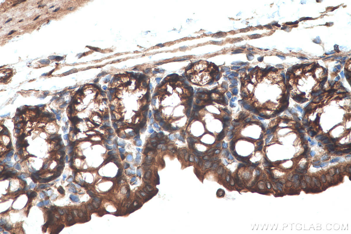 Immunohistochemical analysis of paraffin-embedded mouse colon tissue slide using KHC0698 (PRKCSH IHC Kit).