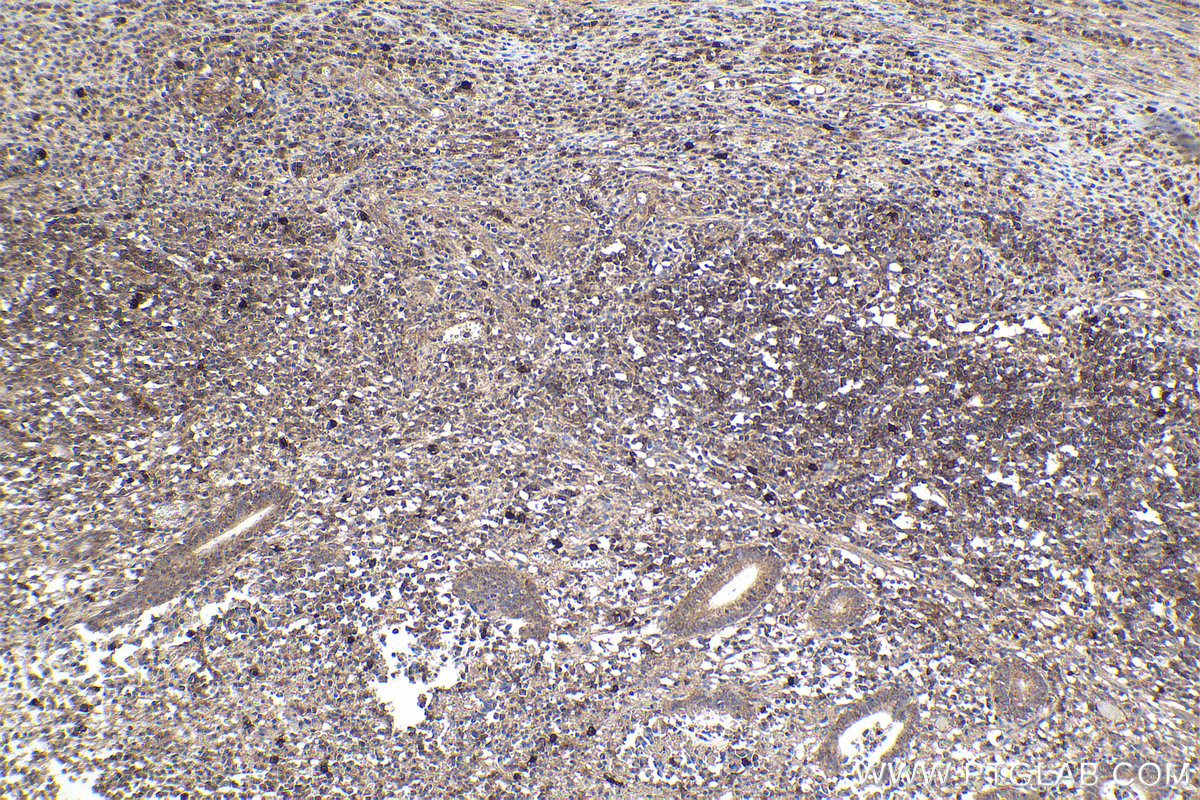 Immunohistochemical analysis of paraffin-embedded human appendicitis tissue slide using KHC1911 (PRKD2 IHC Kit).