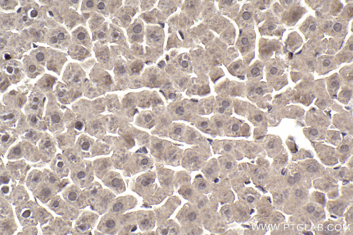 Immunohistochemical analysis of paraffin-embedded rat liver tissue slide using KHC1911 (PRKD2 IHC Kit).
