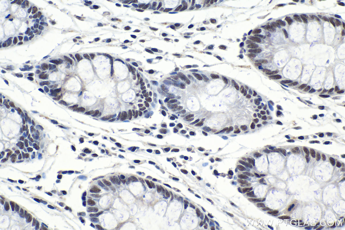 Immunohistochemical analysis of paraffin-embedded human colon tissue slide using KHC1030 (PRKDC IHC Kit).