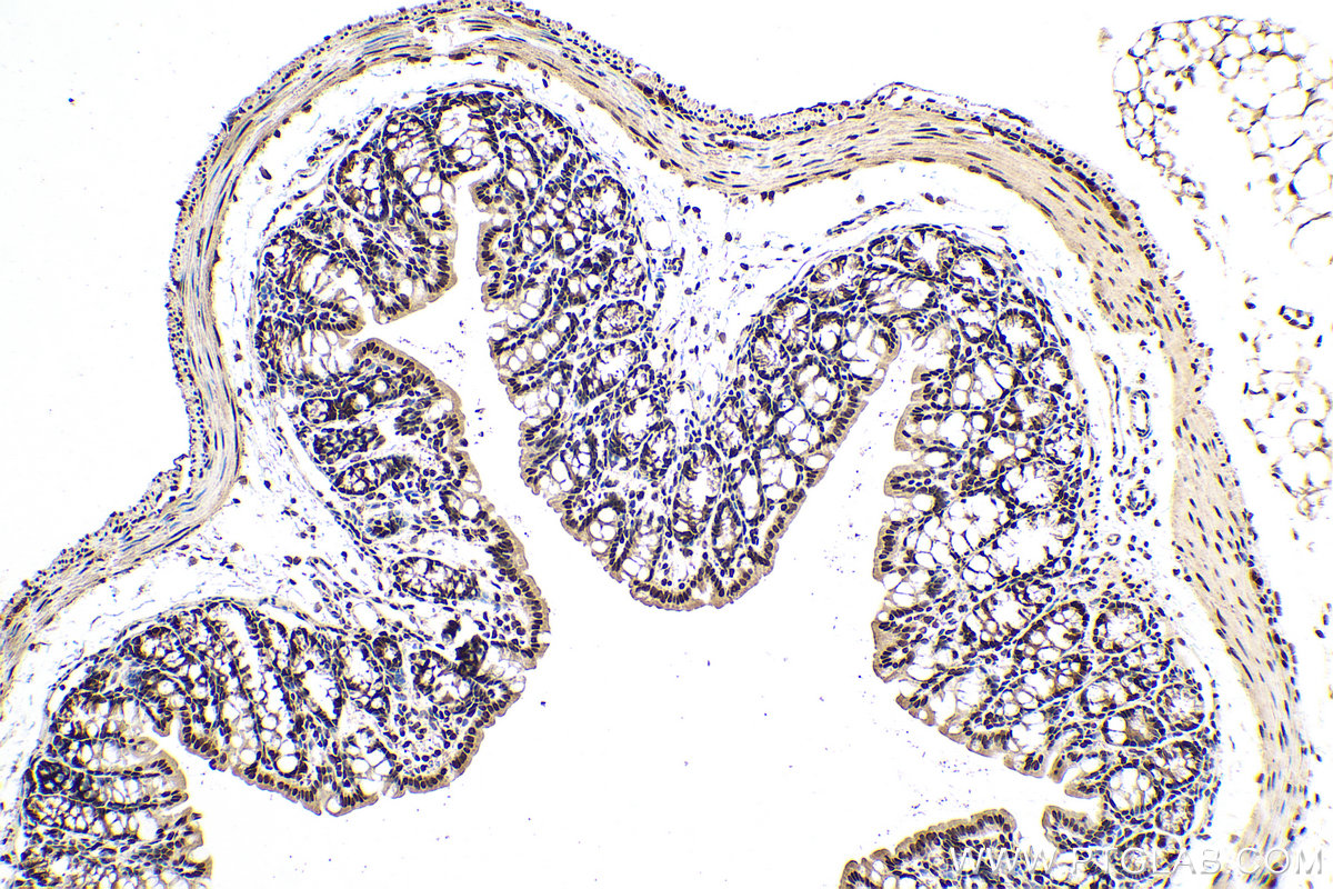 Immunohistochemical analysis of paraffin-embedded mouse colon tissue slide using KHC0832 (PRMT1 IHC Kit).