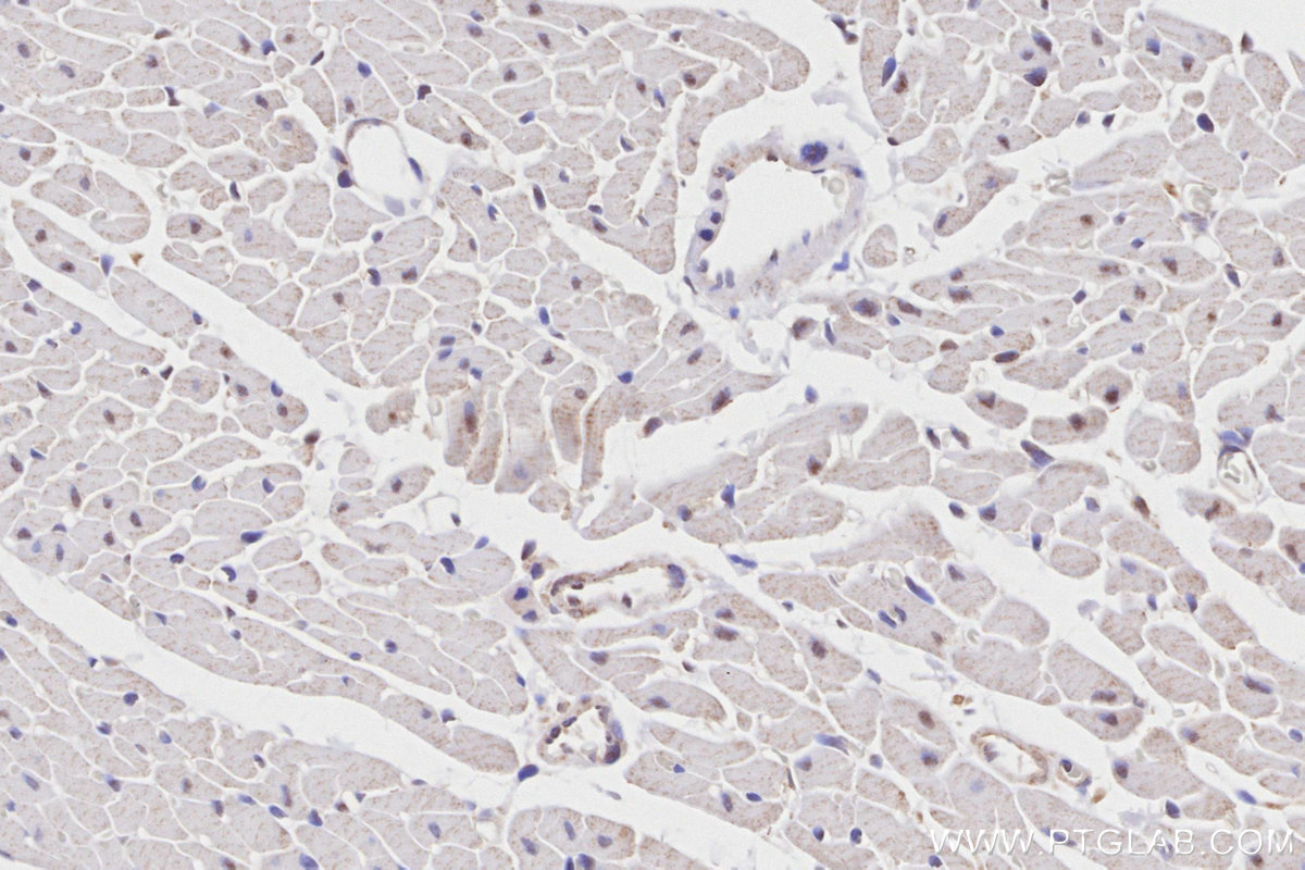 Immunohistochemical analysis of paraffin-embedded rat heart tissue slide using KHC2760 (PROX1 IHC Kit).