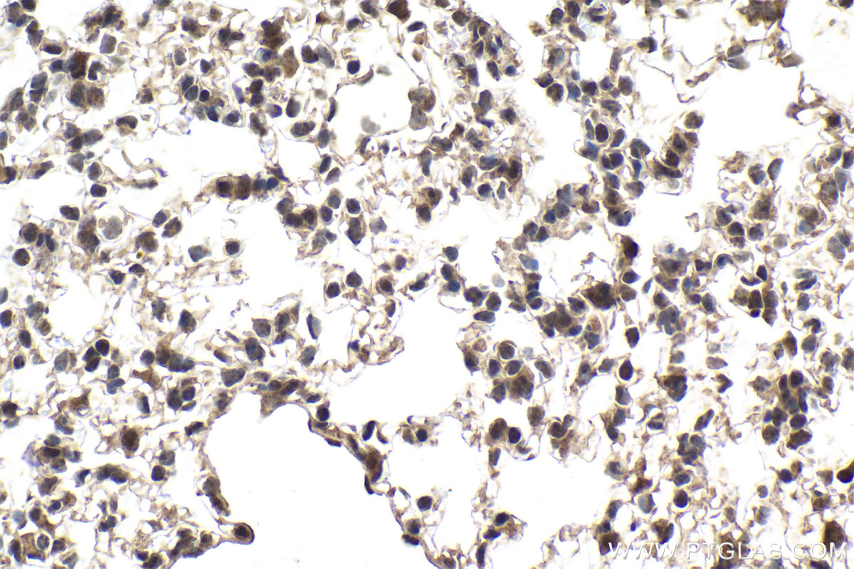Immunohistochemical analysis of paraffin-embedded mouse lung tissue slide using KHC2000 (PRPF19 IHC Kit).