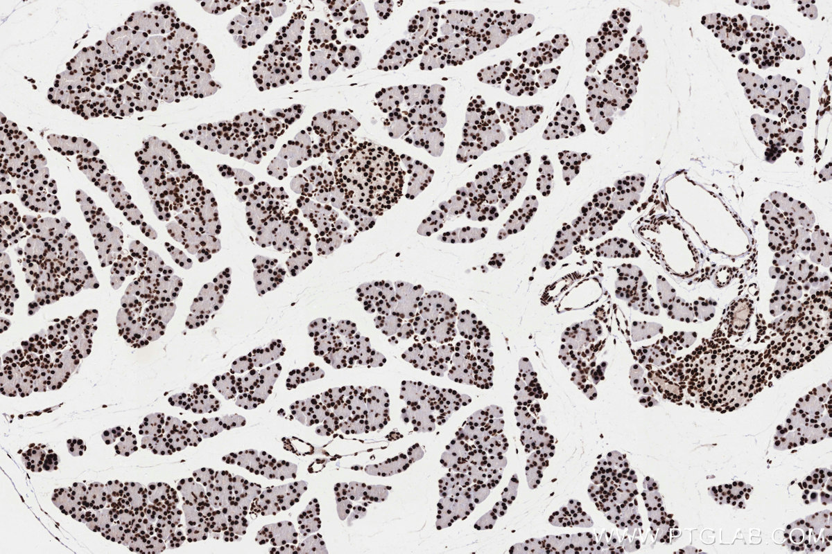 Immunohistochemical analysis of paraffin-embedded rat pancreas tissue slide using KHC3303 (PRPF31 IHC Kit).