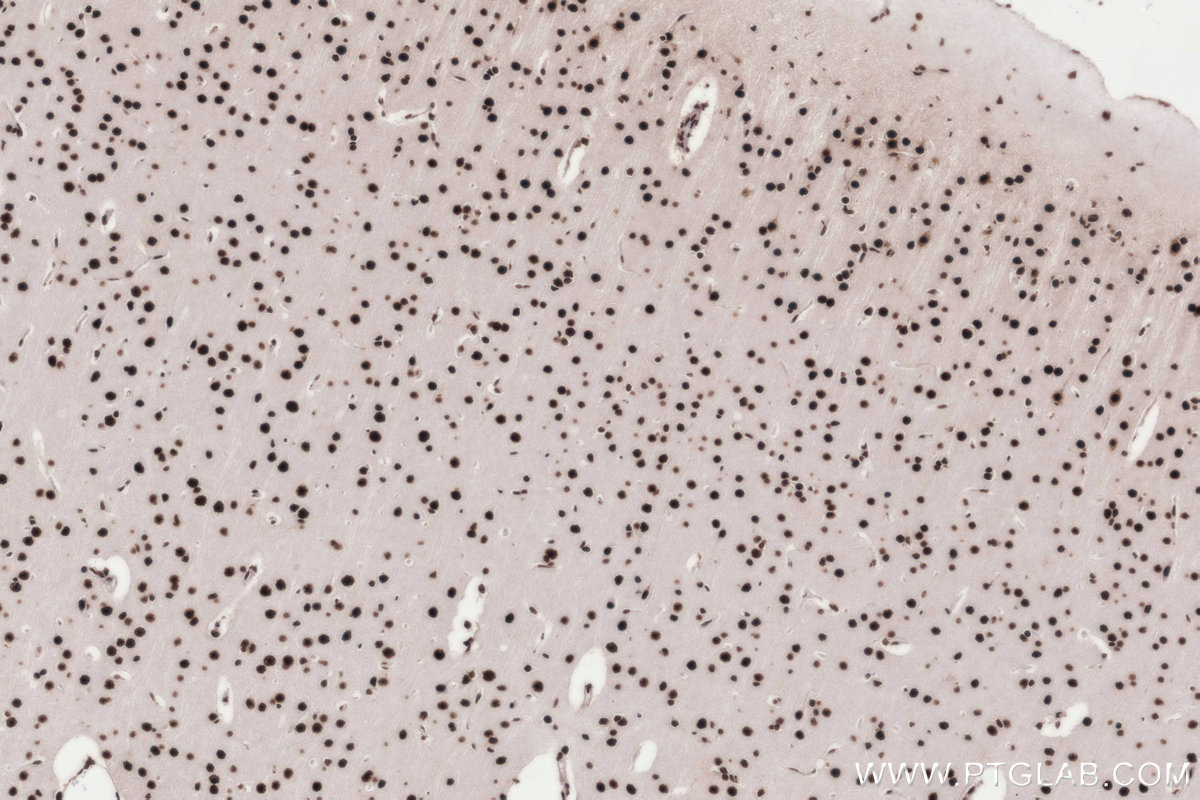 Immunohistochemical analysis of paraffin-embedded rat brain tissue slide using KHC3303 (PRPF31 IHC Kit).