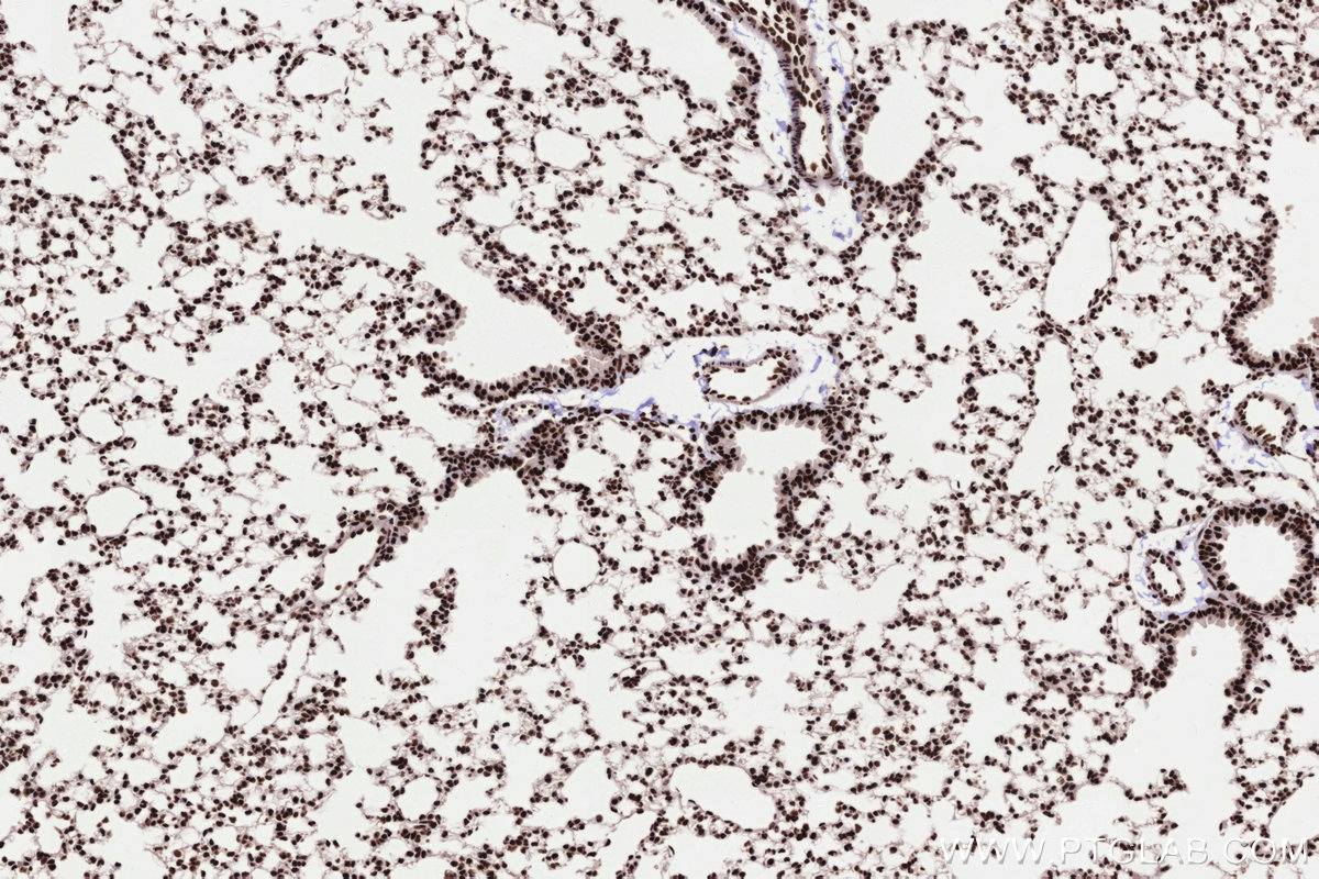 Immunohistochemical analysis of paraffin-embedded mouse lung tissue slide using KHC3303 (PRPF31 IHC Kit).
