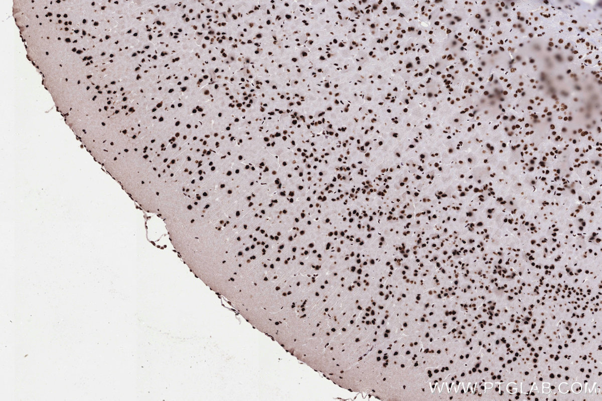 Immunohistochemical analysis of paraffin-embedded mouse brain tissue slide using KHC3303 (PRPF31 IHC Kit).