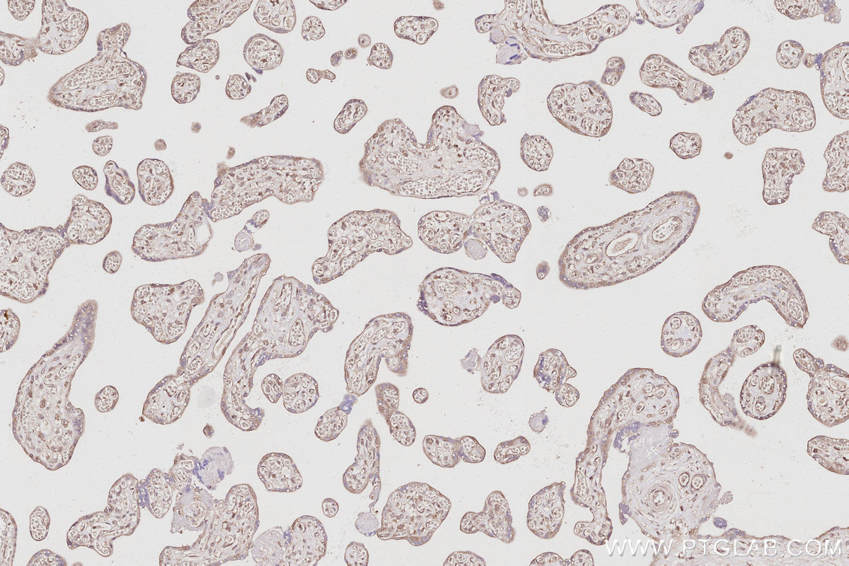 Immunohistochemical analysis of paraffin-embedded human placenta tissue slide using KHC3076 (PRRC2C IHC Kit).
