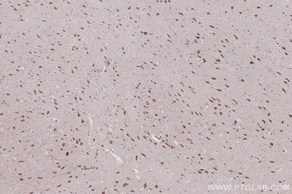 Immunohistochemical analysis of paraffin-embedded rat brain tissue slide using KHC3076 (PRRC2C IHC Kit).