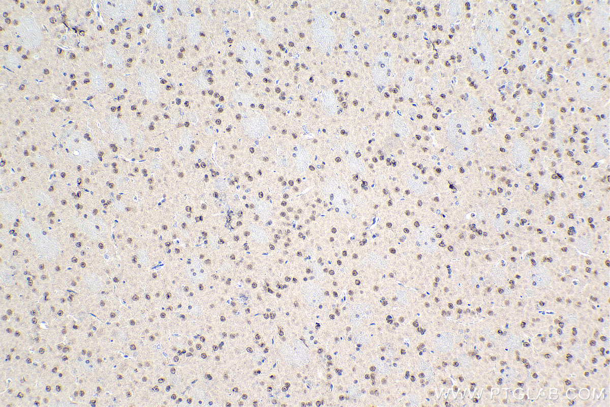 Immunohistochemical analysis of paraffin-embedded rat brain tissue slide using KHC1474 (PSIP1 IHC Kit).