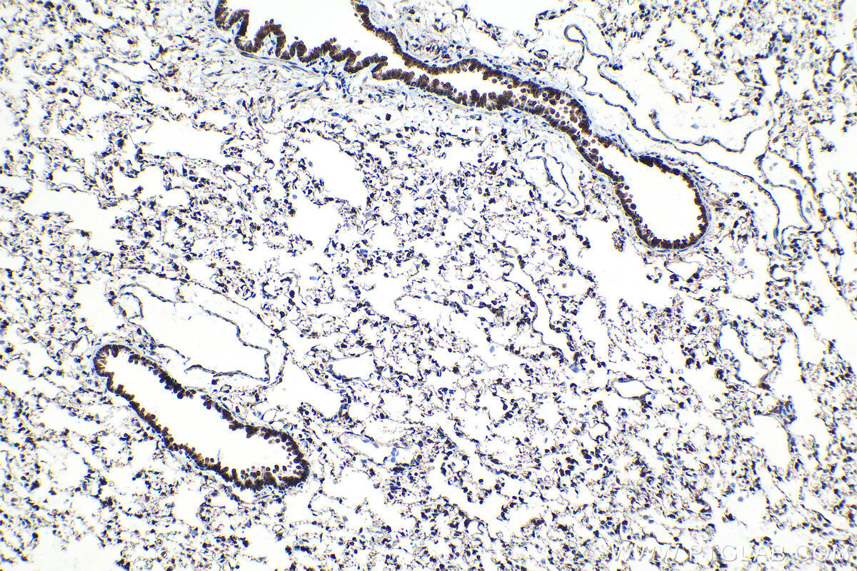 Immunohistochemical analysis of paraffin-embedded rat lung tissue slide using KHC1571 (PSMA5 IHC Kit).