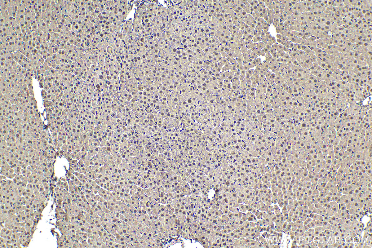 Immunohistochemical analysis of paraffin-embedded rat liver tissue slide using KHC1638 (PSMA6 IHC Kit).