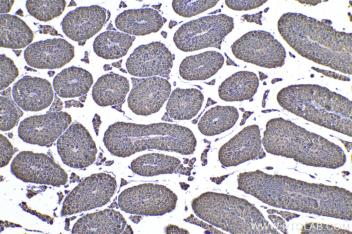 Immunohistochemical analysis of paraffin-embedded mouse testis tissue slide using KHC0983 (PSMA8 IHC Kit).