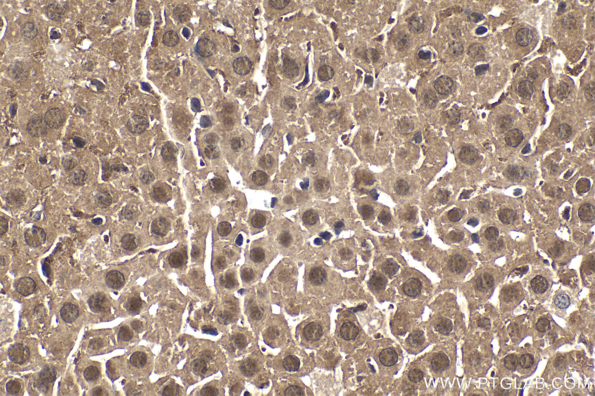 Immunohistochemical analysis of paraffin-embedded mouse liver tissue slide using KHC1550 (PSMB1 IHC Kit).