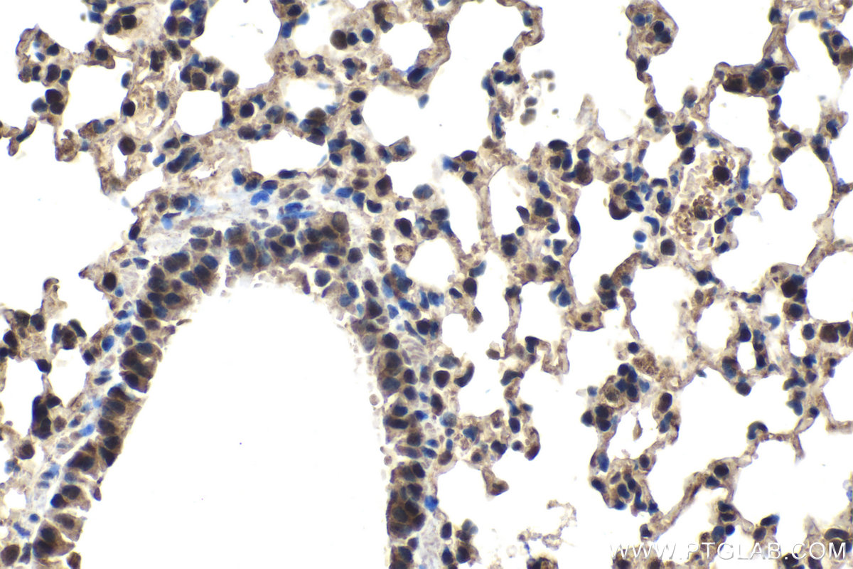 Immunohistochemical analysis of paraffin-embedded mouse lung tissue slide using KHC1550 (PSMB1 IHC Kit).