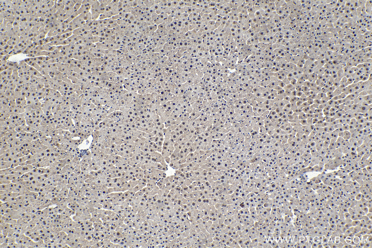 Immunohistochemical analysis of paraffin-embedded rat liver tissue slide using KHC1550 (PSMB1 IHC Kit).