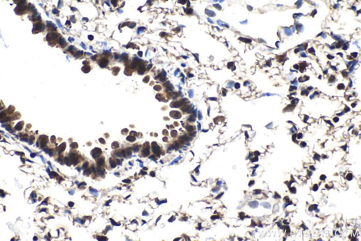 Immunohistochemical analysis of paraffin-embedded rat lung tissue slide using KHC1550 (PSMB1 IHC Kit).