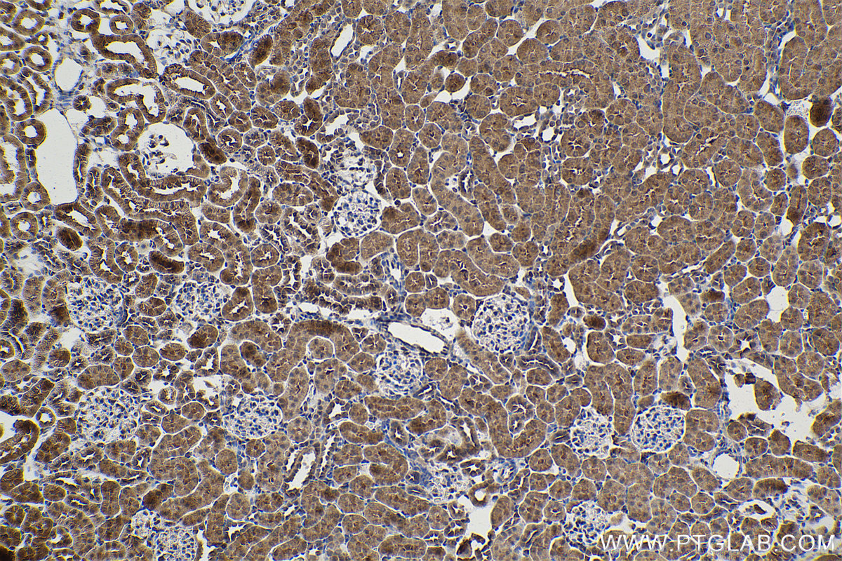 Immunohistochemical analysis of paraffin-embedded rat kidney tissue slide using KHC1591 (PSMB10 IHC Kit).