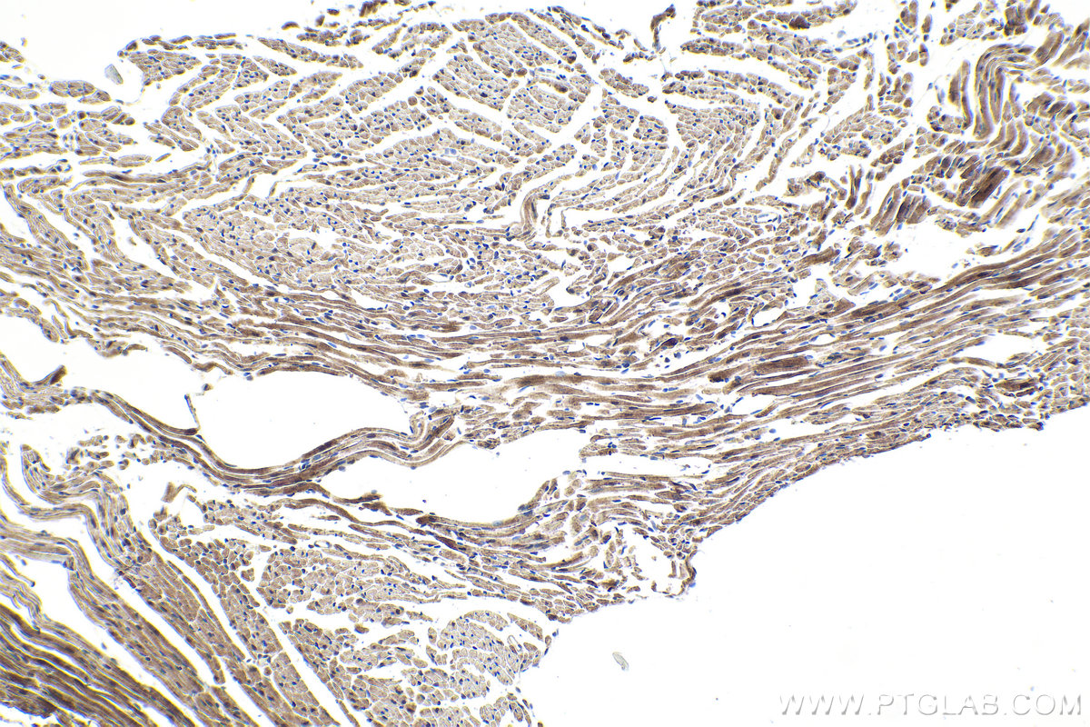 Immunohistochemical analysis of paraffin-embedded mouse heart tissue slide using KHC1615 (PSMB2 IHC Kit).