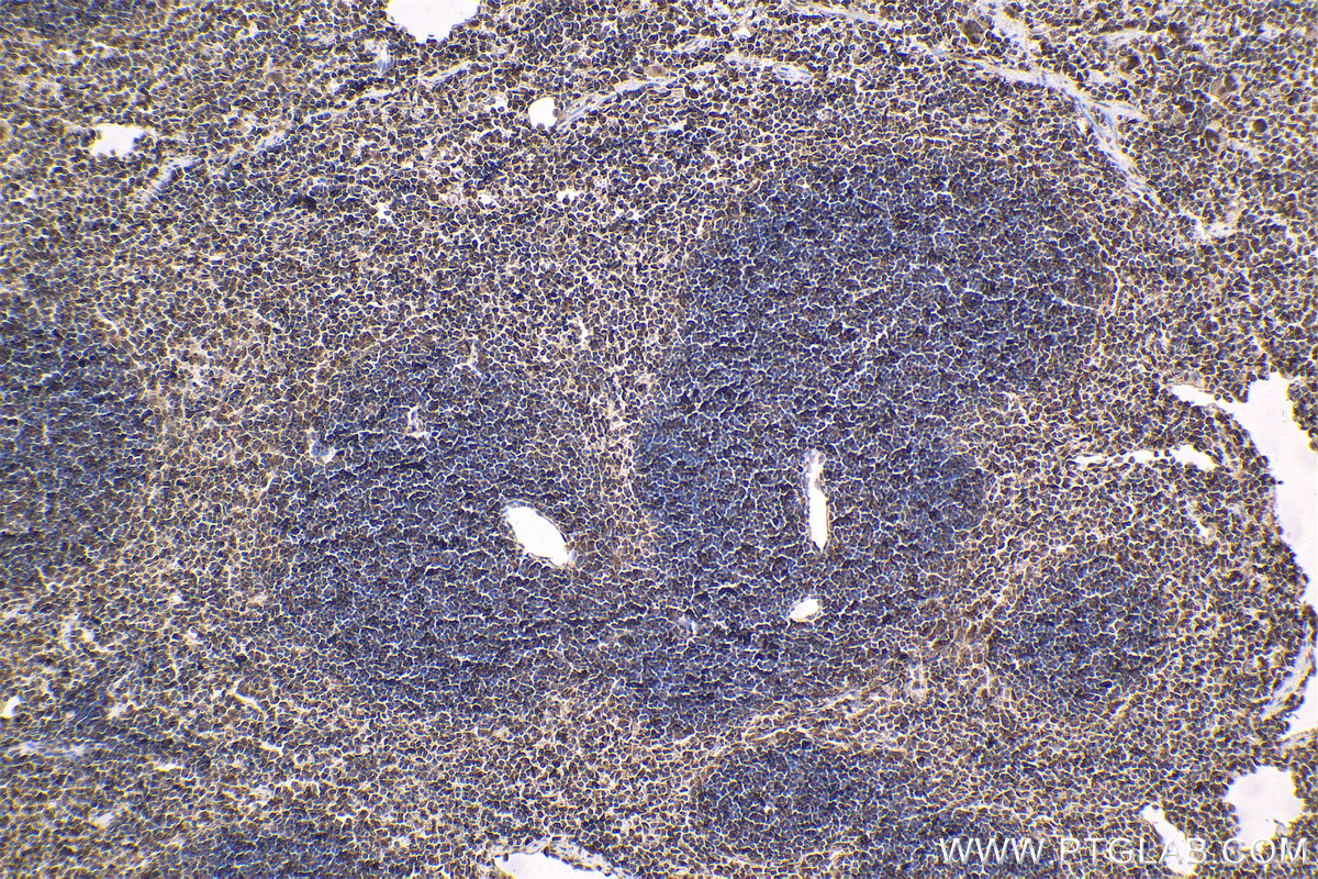 Immunohistochemical analysis of paraffin-embedded mouse spleen tissue slide using KHC1614 (PSMB3 IHC Kit).