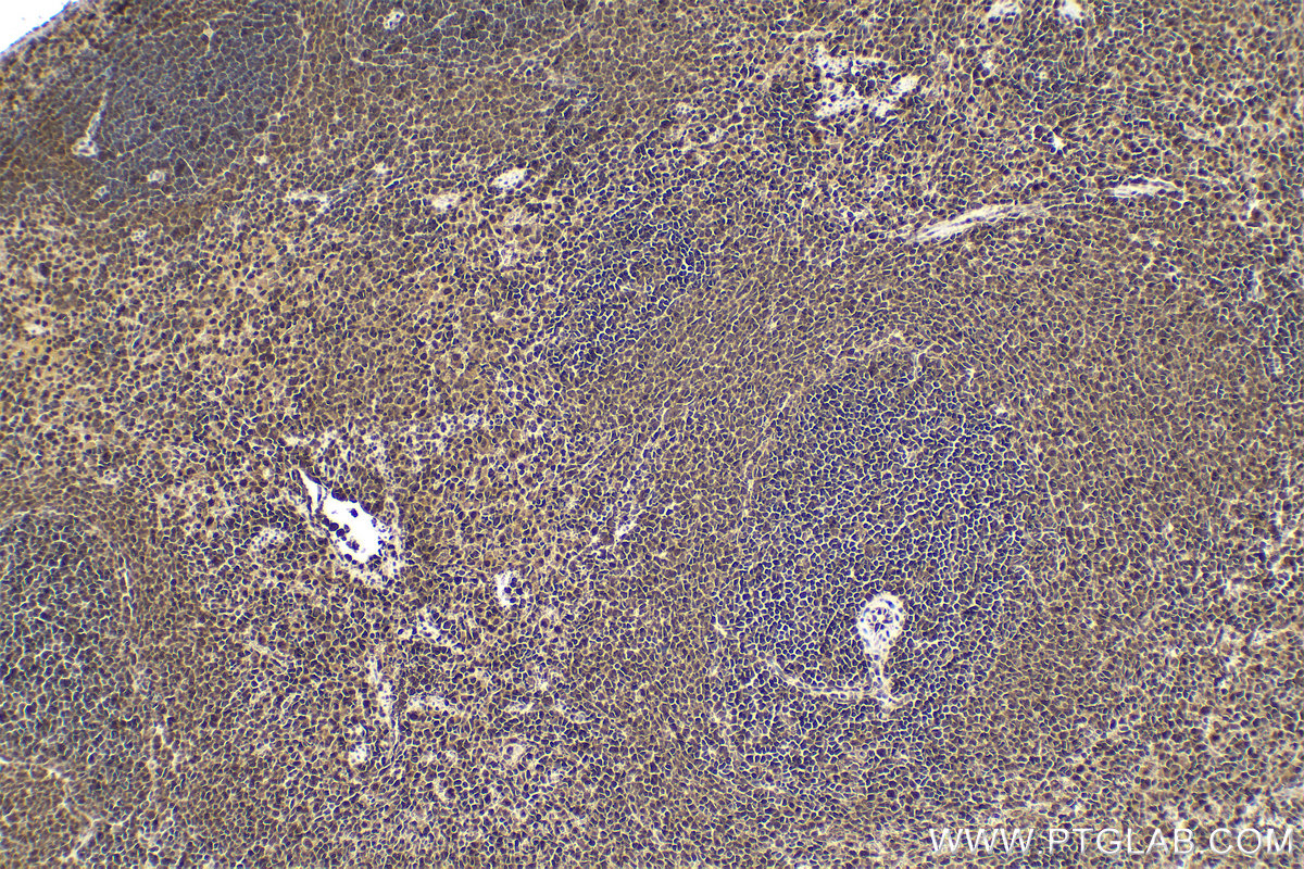 Immunohistochemical analysis of paraffin-embedded rat spleen tissue slide using KHC1614 (PSMB3 IHC Kit).