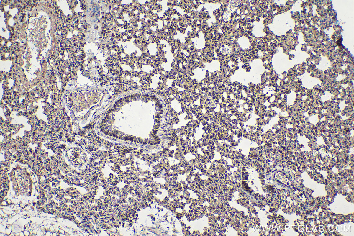 Immunohistochemical analysis of paraffin-embedded mouse lung tissue slide using KHC1614 (PSMB3 IHC Kit).