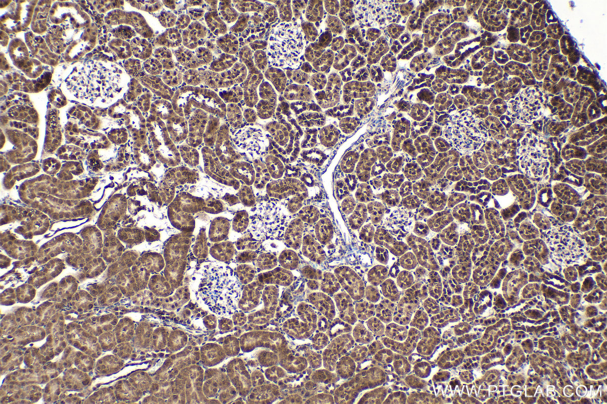 Immunohistochemical analysis of paraffin-embedded rat kidney tissue slide using KHC1614 (PSMB3 IHC Kit).