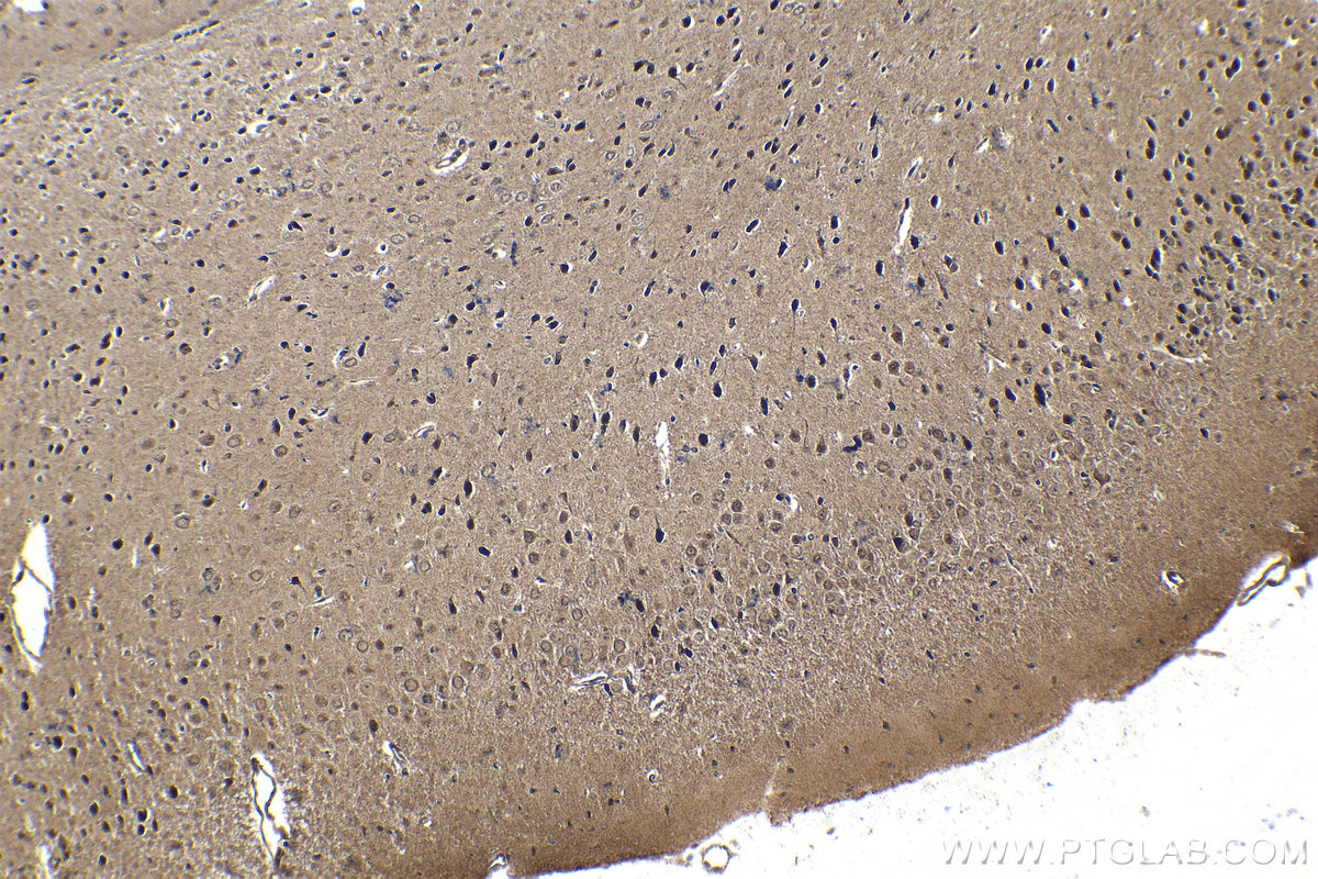 Immunohistochemical analysis of paraffin-embedded mouse brain tissue slide using KHC1573 (PSMB6 IHC Kit).