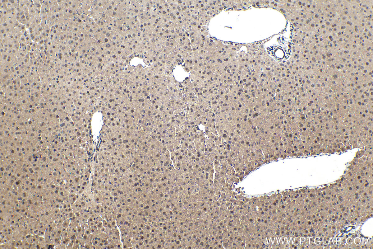 Immunohistochemical analysis of paraffin-embedded mouse liver tissue slide using KHC1573 (PSMB6 IHC Kit).