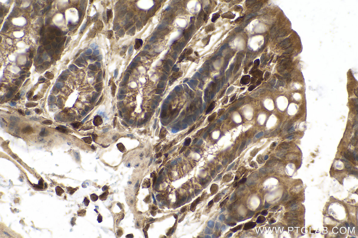 Immunohistochemical analysis of paraffin-embedded mouse colon tissue slide using KHC0780 (PSMB8 IHC Kit).