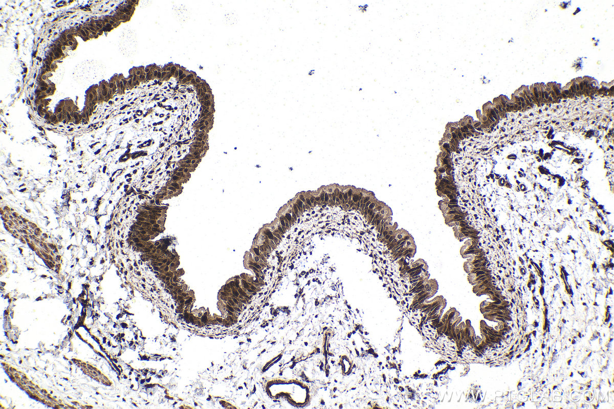 Immunohistochemical analysis of paraffin-embedded rat bladder tissue slide using KHC1570 (PSMB9 IHC Kit).