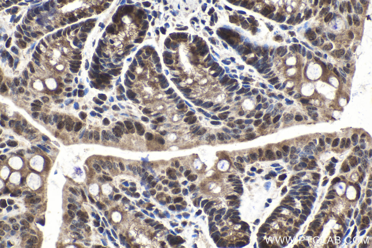 Immunohistochemical analysis of paraffin-embedded mouse colon tissue slide using KHC1541 (PSMC3 IHC Kit).