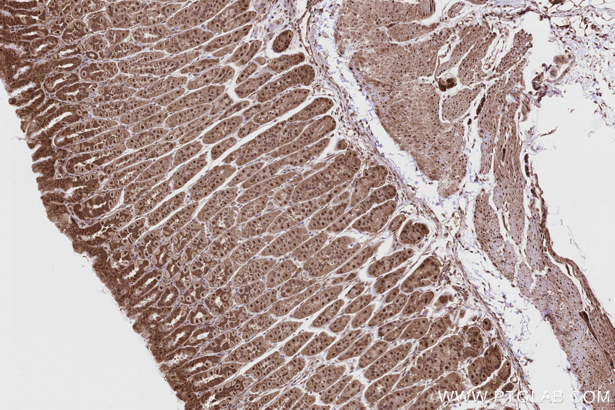 Immunohistochemical analysis of paraffin-embedded mouse stomach tissue slide using KHC2839 (PSMD1 IHC Kit).
