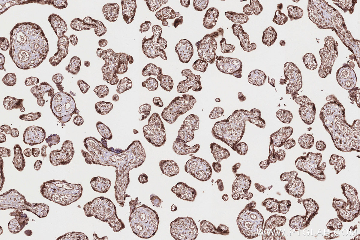 Immunohistochemical analysis of paraffin-embedded human placenta tissue slide using KHC2839 (PSMD1 IHC Kit).