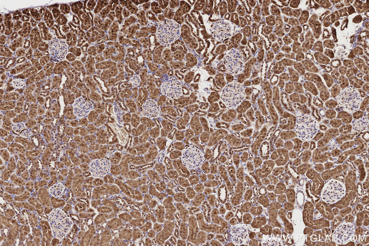 Immunohistochemical analysis of paraffin-embedded rat kidney tissue slide using KHC2839 (PSMD1 IHC Kit).