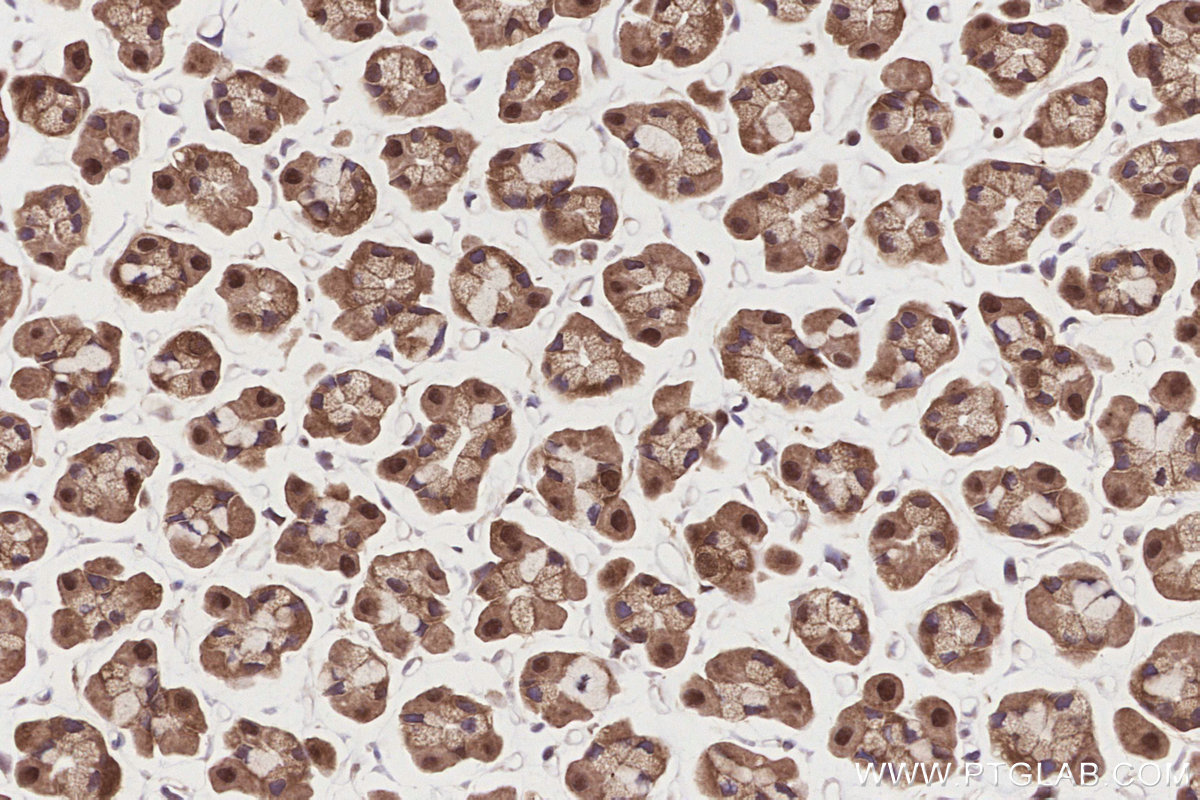 Immunohistochemical analysis of paraffin-embedded rat stomach tissue slide using KHC2839 (PSMD1 IHC Kit).